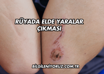 Rüyada Elde Yaralar Çıkması