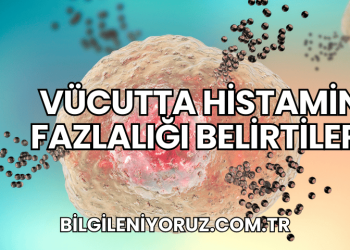 Vücutta Histamin Fazlalığı Belirtileri